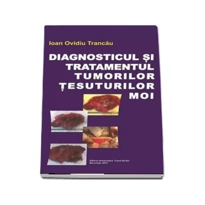 Diagnosticul si tratamentul tumorilor tesuturilor moi