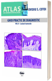 Ghid practic de diagnostic. Volumul al II-lea. Leziuni tumorale