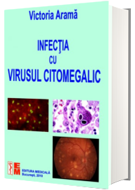 Infectia cu virusul citomegalic - Victoria Arama