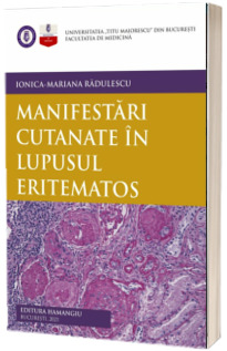 Manifestari cutanate in lupusul eritematos