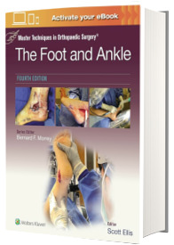 Master Techniques in Orthopaedic Surgery: The Foot and Ankle: Print + eBook with Multimedia