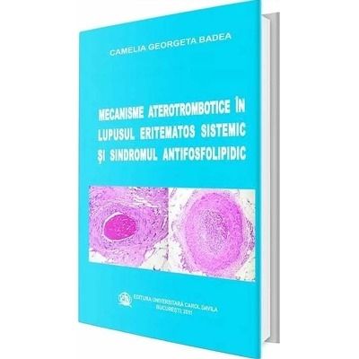 Mecanisme aterotrombotice in lupusul eritematos sistemic si sindromul antifosfolipidic