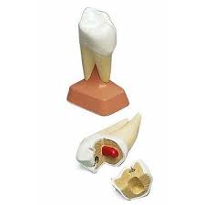 Molar superior cu radacina dubla