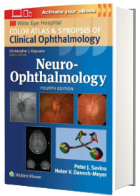 Neuro-Ophthalmology: Print + eBook with Multimedia