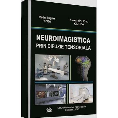 Neuroimagistica prin difuzie tensioriala