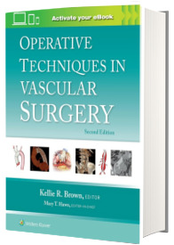 Operative Techniques in Vascular Surgery