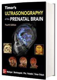 Timor s Ultrasonography of the Prenatal Brain